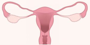자궁경부암 증상 및 치료방법